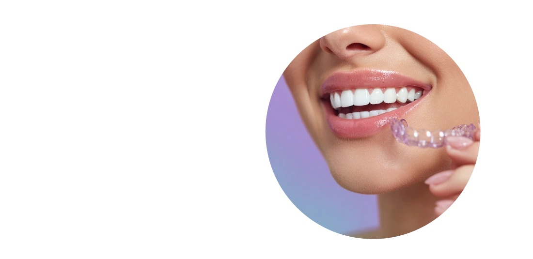 Элайнеры FlexiLigner в рассрочку