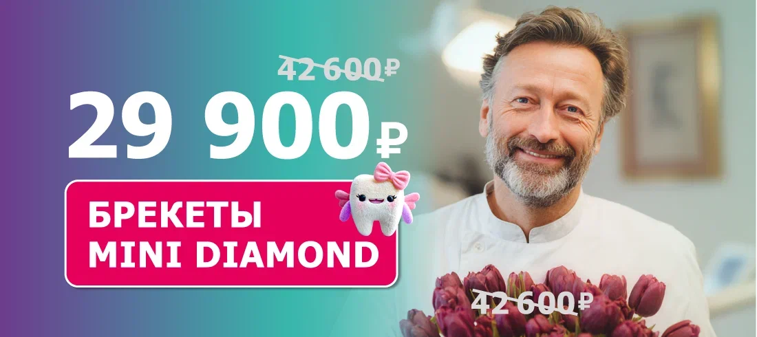 Брекеты Mini Diamond с установкой за 29 900 ₽