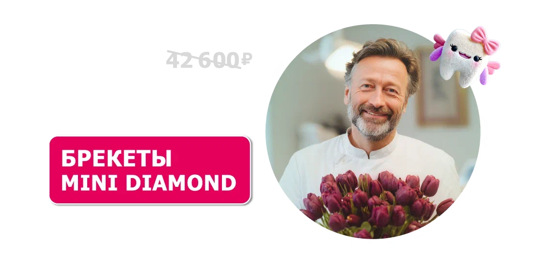 Брекеты Mini Diamond с установкой за 29 900 ₽