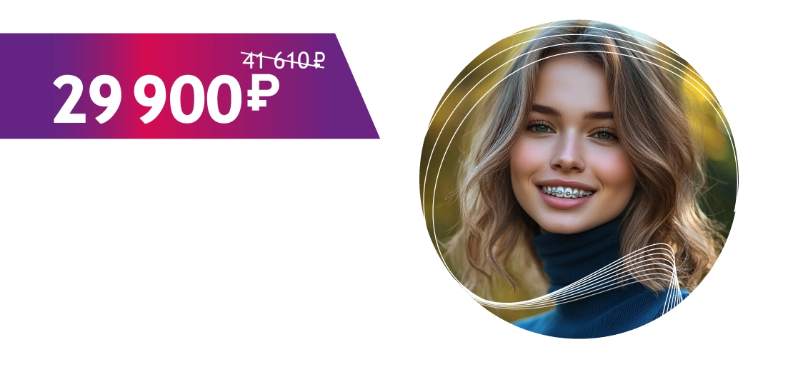 Брекет-система Mini Diamon