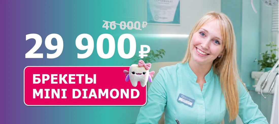 Брекеты Mini Diamond с установкой за 29 900 ₽