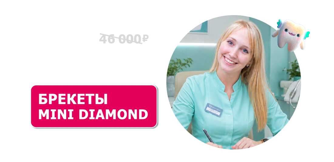 Брекеты Mini Diamond с установкой за 29 900 ₽