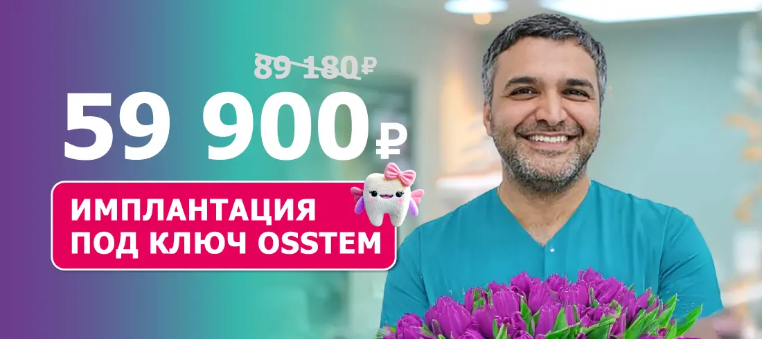 Имплантация под ключ Osstem за 59 900 ₽